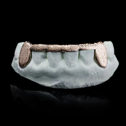 SOLID GOLD DIAMOND DUST GRILLZ WITH BRIDGE BAR