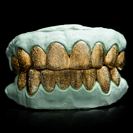 SOLID GOLD DIAMOND DUST GRILLZ